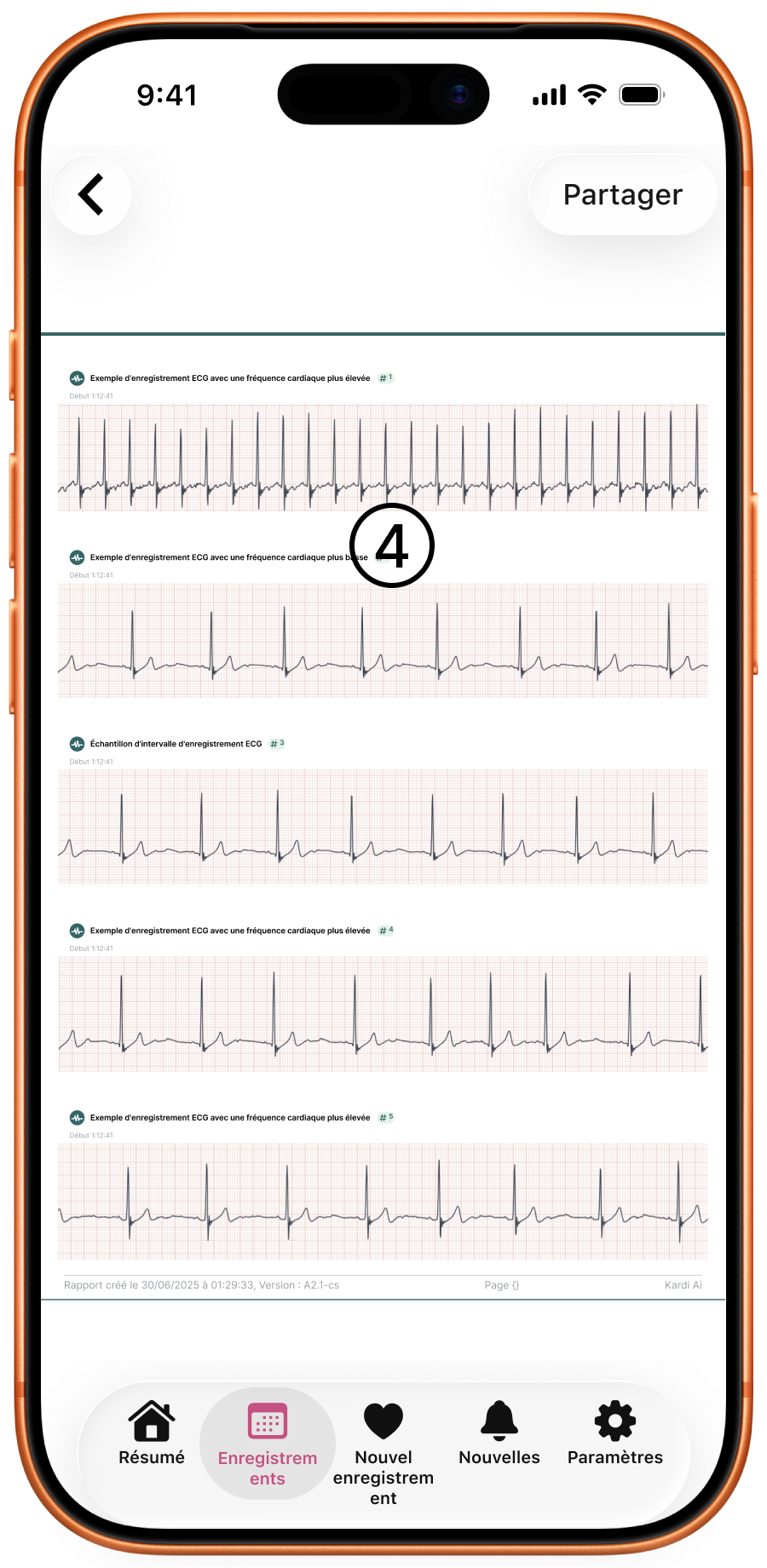 Page 2 du rapport – aperçus des différentes sections de l’ECG